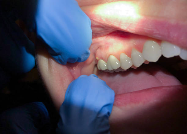 Best Cosmetic Emergency Dentistry in Elmo, TX
