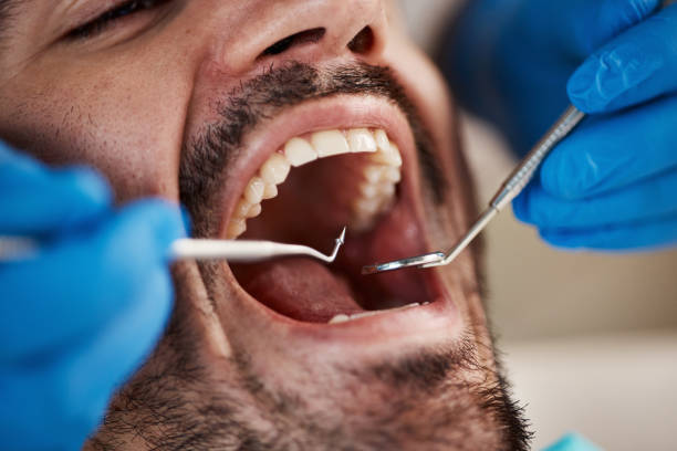 Best Emergency Dental Care for Broken or Chipped Teeth in Elmo, TX