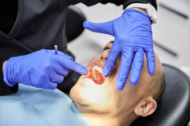 Best Emergency Wisdom Teeth Removal in Elmo, TX